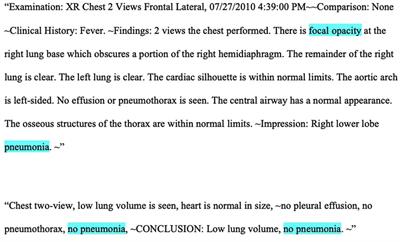 The development of a novel natural language processing tool to identify pediatric chest radiograph reports with pneumonia